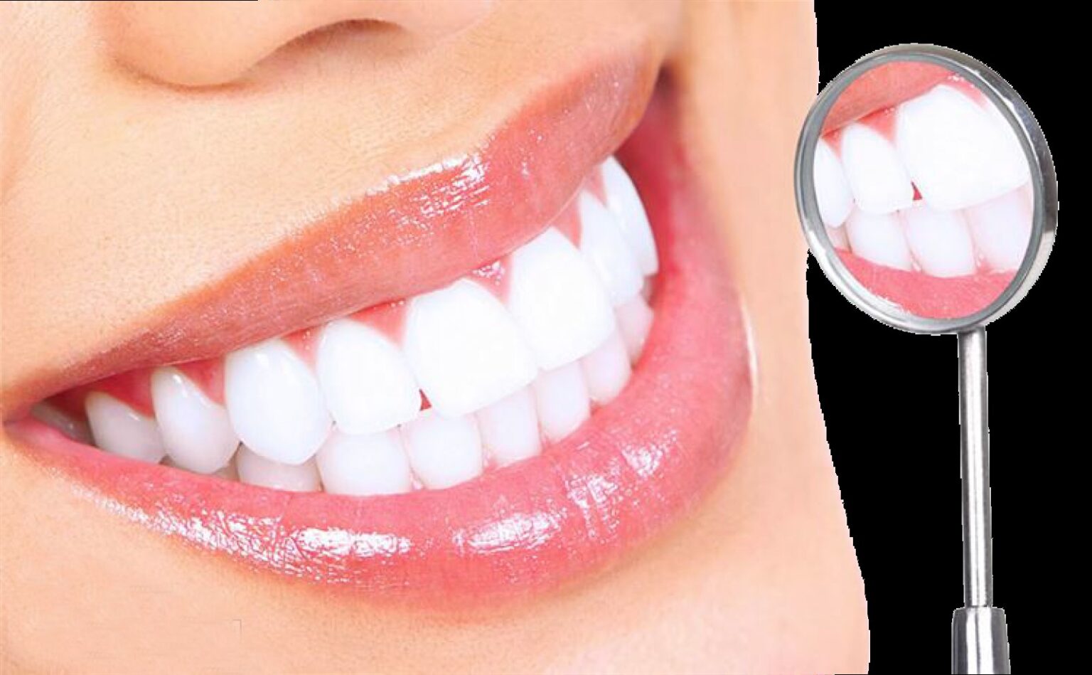 Lạm dụng thuốc tẩy trắng răng và nguy cơ tai biến 